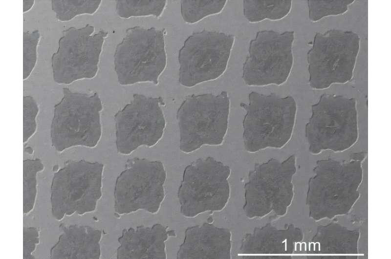 Micrograph of the new metal matrix composite that mimics the structure of concrete on a tiny scale. Photo credit: Chenwei Shao U of T researchers are developing ultra-strong, lightweight metal composites that can withstand extreme heat